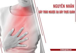 nguyên nhân trào ngược dạ dày thực quản