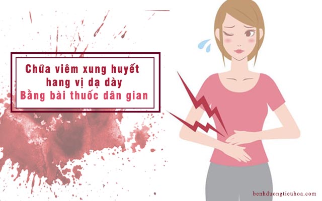 chữa viêm hang vị dạ dày xung huyết bằng thuốc dân gian