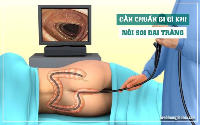 giảm đau khi nội soi đại tràng