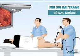 nội soi đại tràng có bị đau hay không