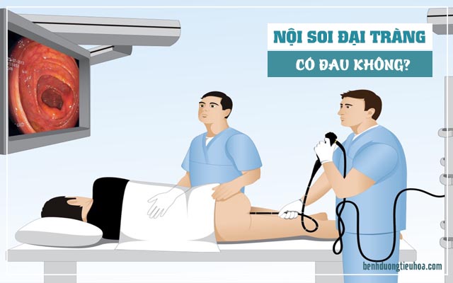 nội soi đại tràng có bị đau hay không