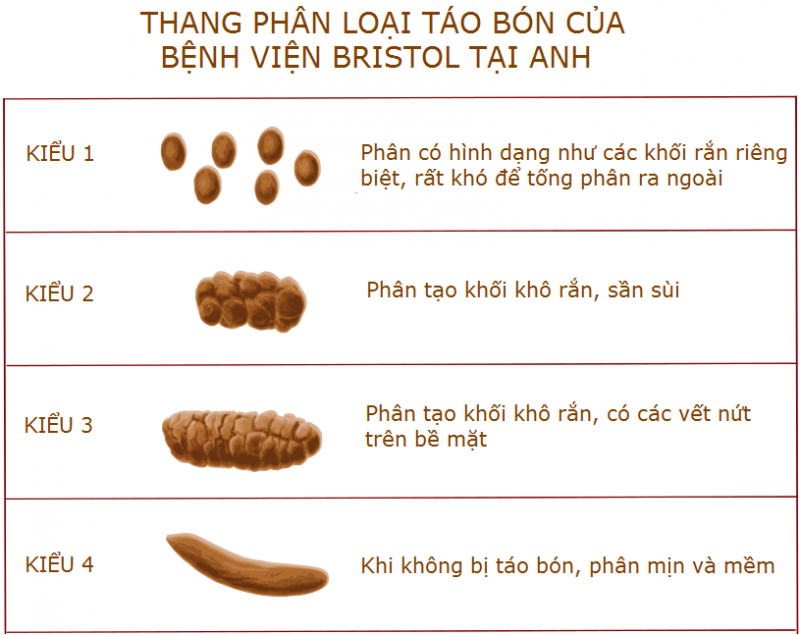 Phân loại các kiểu táo bón