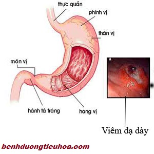 viem-niem-mac-hang-vi-da-day-co-nguy-hiem-khong(2)