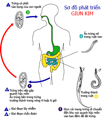 thuoc-va-cach-chua-tri-giun-kim-o-tre-em-va-nguoi-lon1