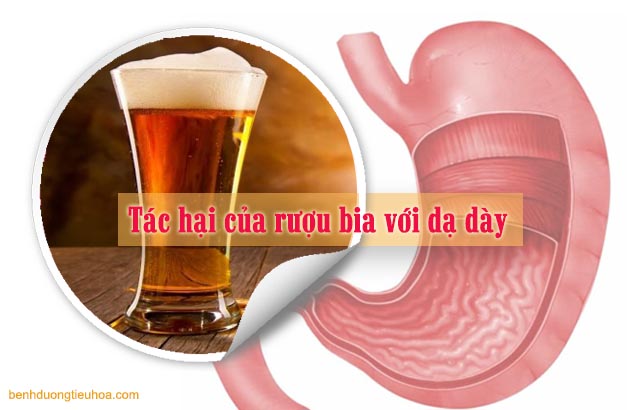 tác hại của rượu bia tới dạ dày