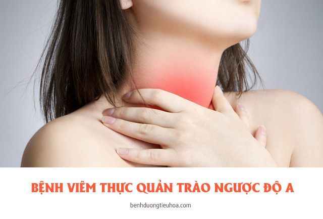 bệnh viêm thực quản trào ngược cấp độ A