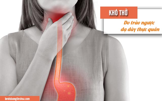 trào ngược dạ dày thực quản gây khó thở