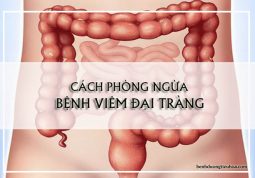 cách phòng ngừa viêm đại tràng