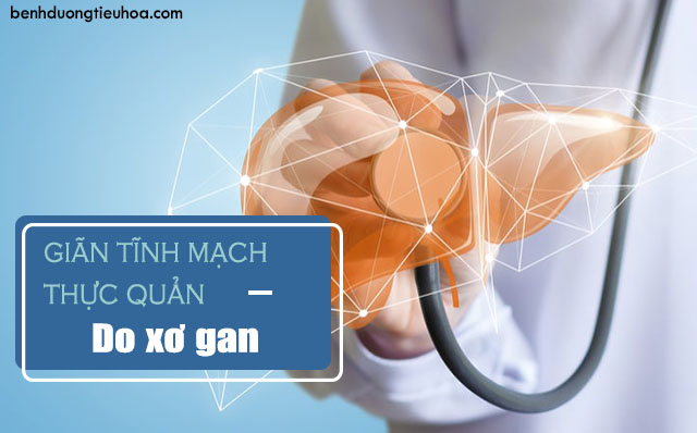 các nguyên nhân gây giãn tĩnh mạch thực quản