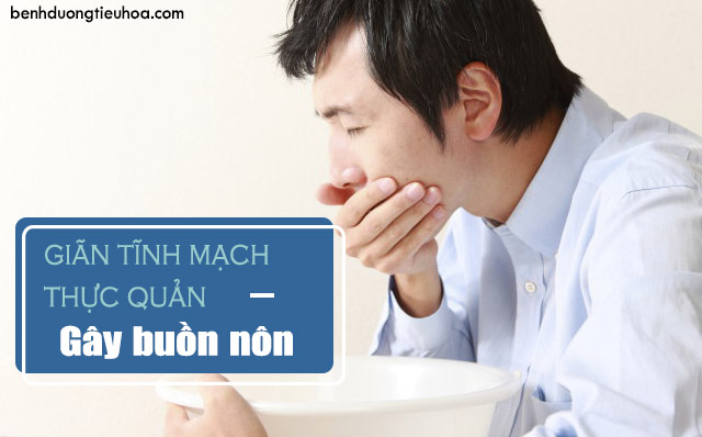 nhận biết bệnh giãn tĩnh mạch thực quản