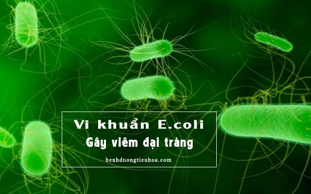 viêm đại tràng vì vi khuẩn E.coli