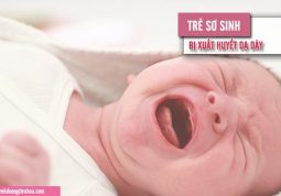 những điều cần biết về xuất huyết dạ dày ở trẻ mới sinh