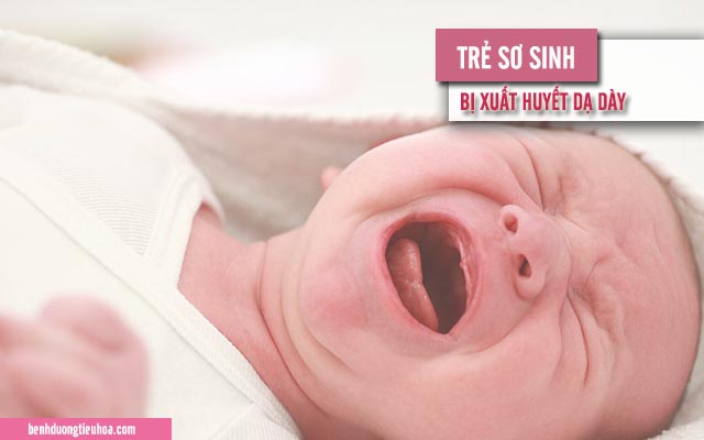 những điều cần biết về xuất huyết dạ dày ở trẻ mới sinh