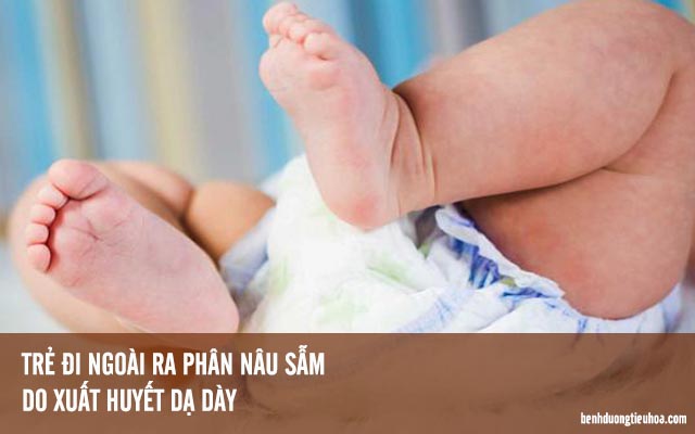 dấu hiệu của xuất huyết dạ dày ở tuổi sơ sinh