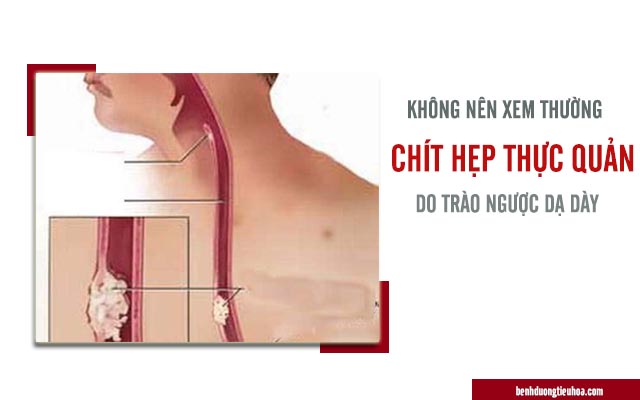 trào ngược dạ dày thực quản gây chít hẹp dạ dày