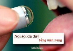 viên nang nội soi dạ dày