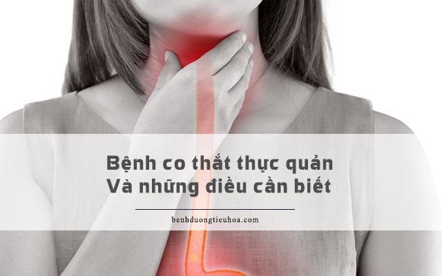 những điều cần biết về bệnh co thắt thực quản