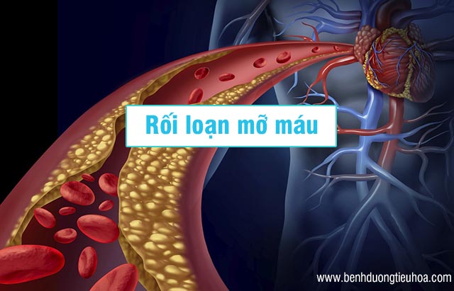 Rối loạn mỡ máu