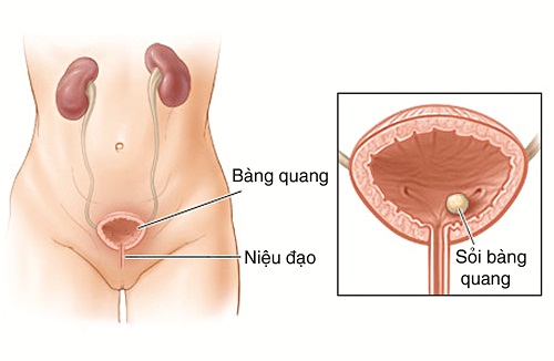 Nhung-nguyen-nhan-gay-dau-bung-duoi-thuong-gap6