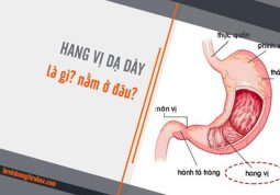 hang vị dạ dày là gì nằm ở đâu