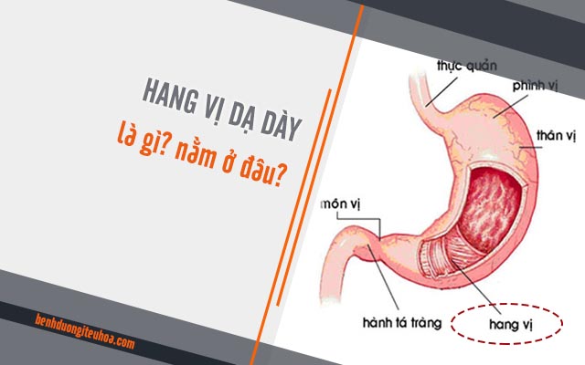 hang vị dạ dày là gì nằm ở đâu