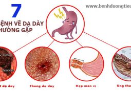 TOP 7 loại bệnh về dạ dày thường gặp nhất