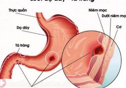 vi khuẩn hp có nguy hiểm không