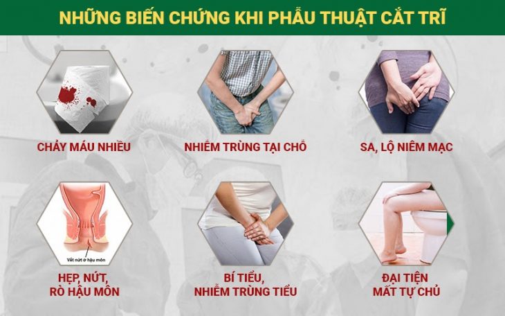 Những biến chứng thường gặp sau khi cắt trĩ