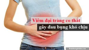 Viêm đại tràng co thắt