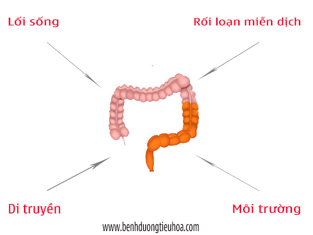 Nguyên nhân gây viêm đại tràng mãn tính