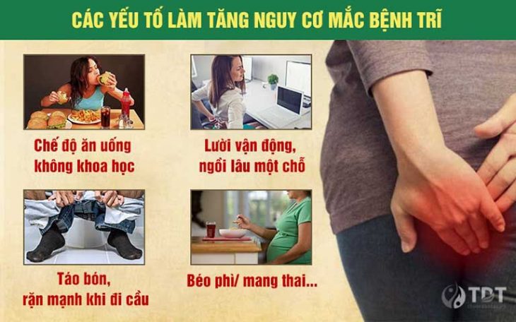 Những điều dễ dẫn đến bệnh trĩ