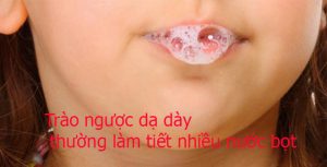 triệu chứng tiết nước bọt khi trào ngược dạ dày