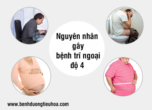 Nguyên nhân gây bệnh trĩ ngoại độ 4