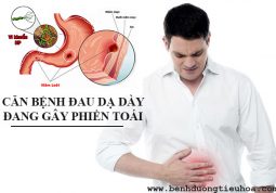 cách chữa bệnh đau dạ dày bằng thuốc nam