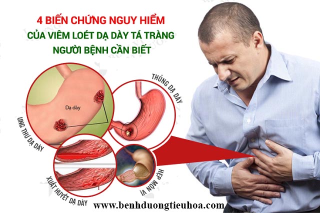 Biến chứng nguy hiểm của bệnh dạ dày