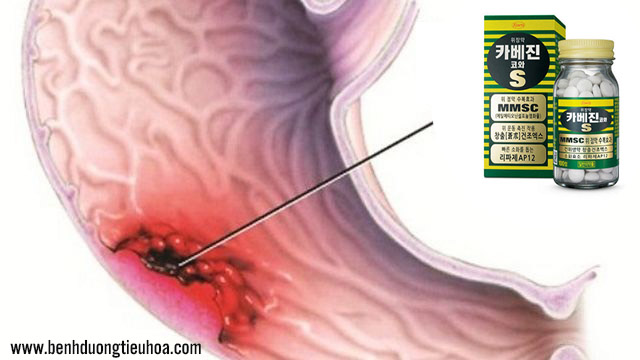 Thông tin thuốc đau dạ dày Kyabeijin MMSC Kowa của Nhật