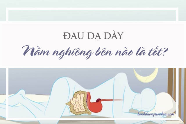 bị bệnh đau dạ dày nên nằm nghiêng về bên nào