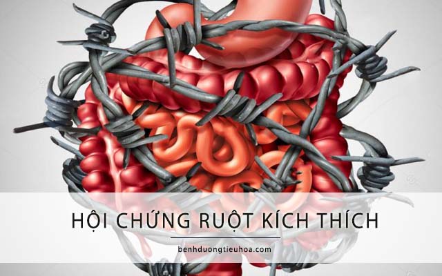 hội chứng ruột kích thích khiến đi ngoài lúc táo lúc lỏng