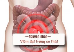 nguyên nhân gây bệnh viêm đại tràng co thắt