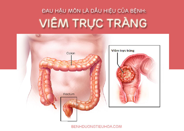 nguyên nhân đau rát hậu môn