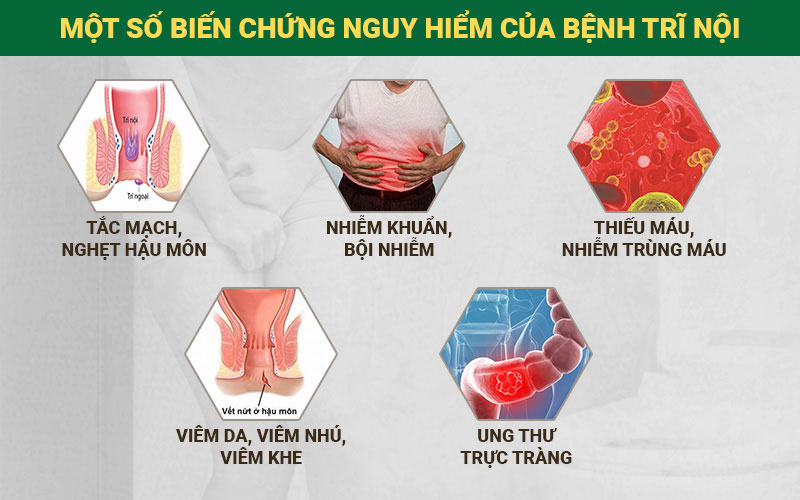 Nếu không chữa trị kịp thời, bệnh nhân trĩ nội có thể gặp phải những biến chứng nguy hiểm