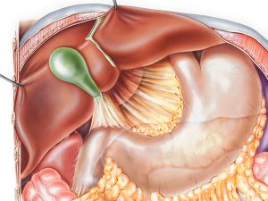 nguyên nhân trào ngược dịch mật 