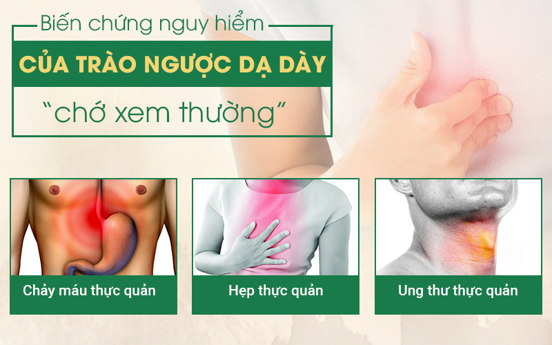 Thuốc Tây giúp giảm nhanh triệu chứng trào ngược nhưng lại khiến bệnh dễ dàng tài phát.