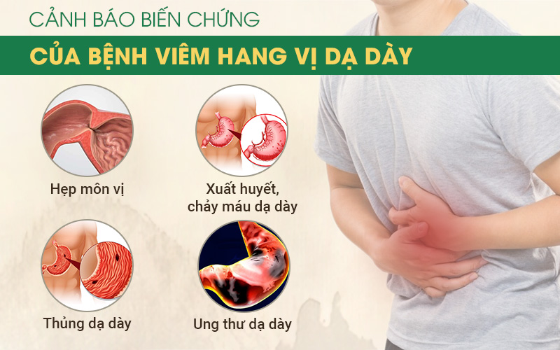 Những biến chứng nguy hiểm của viêm hang vị dạ dày cần phải đề phòng