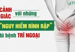 Cảnh báo biến chứng trĩ ngoại