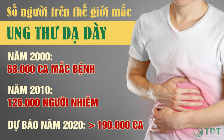 Ung thư dạ dày là dạng ung thư phổ biến thứ 2 trên thế giới