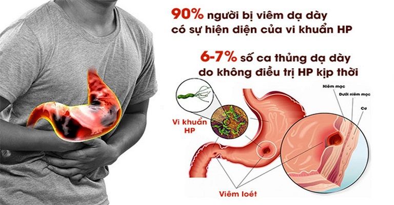 Thống kê về vi khuẩn HP